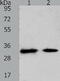 Solute Carrier Family 25 Member 4 antibody, TA321287, Origene, Western Blot image 