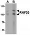 Ring Finger Protein 20 antibody, TA319965, Origene, Western Blot image 