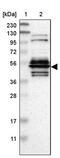 WD Repeat Domain 13 antibody, PA5-51483, Invitrogen Antibodies, Western Blot image 