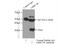Leucine Rich Repeat Containing 18 antibody, 24571-1-AP, Proteintech Group, Immunoprecipitation image 