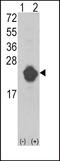 Interleukin 1 Receptor Antagonist antibody, PA5-13428, Invitrogen Antibodies, Western Blot image 