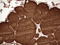 Thyroglobulin antibody, LS-C790224, Lifespan Biosciences, Immunohistochemistry paraffin image 