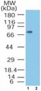 Metastasis Associated 1 Family Member 2 antibody, NB100-56483, Novus Biologicals, Western Blot image 