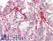 Signal-Induced Proliferation-Associated 1 antibody, LS-B10609, Lifespan Biosciences, Immunohistochemistry paraffin image 