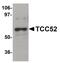 DDB1 And CUL4 Associated Factor 12 antibody, PA5-20939, Invitrogen Antibodies, Western Blot image 