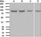 Component Of Inhibitor Of Nuclear Factor Kappa B Kinase Complex antibody, GTX62710, GeneTex, Western Blot image 