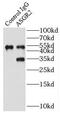Asialoglycoprotein Receptor 2 antibody, FNab00636, FineTest, Immunoprecipitation image 