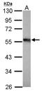 Tubulin Alpha 1b antibody, NBP2-20761, Novus Biologicals, Western Blot image 