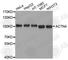 Actinin Alpha 4 antibody, A3284, ABclonal Technology, Western Blot image 