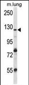 VPS54 Subunit Of GARP Complex antibody, PA5-71766, Invitrogen Antibodies, Western Blot image 
