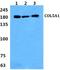 Collagen Type V Alpha 1 Chain antibody, A02283-1, Boster Biological Technology, Western Blot image 