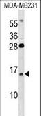 Guanylate Cyclase Activator 2B antibody, LS-C166742, Lifespan Biosciences, Western Blot image 