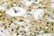 DNA Topoisomerase II Alpha antibody, LS-C177115, Lifespan Biosciences, Immunohistochemistry paraffin image 