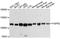 FGFR-2 antibody, LS-C747539, Lifespan Biosciences, Western Blot image 