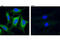 Ribonucleotide Reductase Catalytic Subunit M1 antibody, 8637S, Cell Signaling Technology, Immunocytochemistry image 