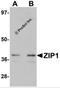 hZIP1 antibody, 6081, ProSci Inc, Western Blot image 