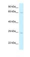 Cathepsin C antibody, orb331087, Biorbyt, Western Blot image 