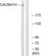 Calcium Voltage-Gated Channel Subunit Alpha1 H antibody, PA5-39530, Invitrogen Antibodies, Western Blot image 