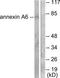 Annexin A6 antibody, TA312988, Origene, Western Blot image 