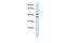 Zinc Finger RANBP2-Type Containing 2 antibody, GTX47181, GeneTex, Western Blot image 