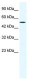 Suppressor Of Variegation 3-9 Homolog 1 antibody, TA330558, Origene, Western Blot image 