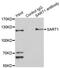 Spliceosome Associated Factor 1, Recruiter Of U4/U6.U5 Tri-SnRNP antibody, STJ111304, St John