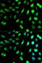 Na(+)/I(-) symporter antibody, orb325093, Biorbyt, Immunocytochemistry image 