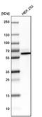 Bifunctional polynucleotide phosphatase/kinase antibody, HPA006782, Atlas Antibodies, Western Blot image 