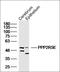 Serine/threonine-protein phosphatase 2A 56 kDa regulatory subunit epsilon isoform antibody, orb312601, Biorbyt, Western Blot image 