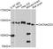 Calcium Voltage-Gated Channel Auxiliary Subunit Alpha2delta 3 antibody, abx125592, Abbexa, Western Blot image 