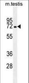 Mbt Domain Containing 1 antibody, LS-C164067, Lifespan Biosciences, Western Blot image 