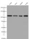 PMS1 Homolog 1, Mismatch Repair System Component antibody, 28186-1-AP, Proteintech Group, Western Blot image 