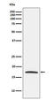 Claudin 4 antibody, M03683, Boster Biological Technology, Western Blot image 