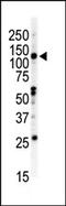 EPH Receptor B2 antibody, AP14297PU-N, Origene, Western Blot image 