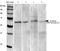 Calcium Voltage-Gated Channel Auxiliary Subunit Gamma 2 antibody, NBP2-22411, Novus Biologicals, Western Blot image 
