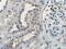 BRCA1 Associated Protein antibody, 26004-1-AP, Proteintech Group, Immunohistochemistry paraffin image 