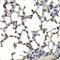 Chromobox 5 antibody, LS-C747673, Lifespan Biosciences, Immunohistochemistry paraffin image 