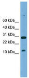 TAL BHLH Transcription Factor 2 antibody, TA341815, Origene, Western Blot image 