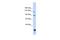 TUB Like Protein 4 antibody, A12042, Boster Biological Technology, Western Blot image 