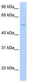 Telomeric Repeat Binding Factor 2 antibody, TA329138, Origene, Western Blot image 