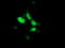 Suppressor Of Cytokine Signaling 3 antibody, LS-C173039, Lifespan Biosciences, Immunofluorescence image 