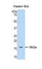 Hemoglobin Subunit Alpha 2 antibody, abx100260, Abbexa, Enzyme Linked Immunosorbent Assay image 