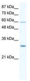DEAD-Box Helicase 31 antibody, TA341619, Origene, Western Blot image 