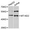 Malonyl-CoA-Acyl Carrier Protein Transacylase antibody, STJ111263, St John