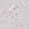 Actin Related Protein 3 antibody, NBP2-33477, Novus Biologicals, Immunohistochemistry paraffin image 