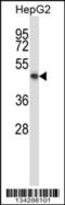 Potassium Two Pore Domain Channel Subfamily K Member 10 antibody, 57-588, ProSci, Western Blot image 