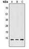 Chromatin Accessibility Complex Subunit 1 antibody, LS-C354610, Lifespan Biosciences, Western Blot image 