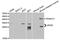 Apolipoprotein D antibody, MBS2516548, MyBioSource, Western Blot image 