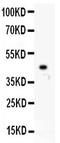 Zinc Finger E-Box Binding Homeobox 2 antibody, LS-C344085, Lifespan Biosciences, Western Blot image 