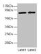 Biogenesis Of Lysosomal Organelles Complex 1 Subunit 1 antibody, CSB-PA00495A0Rb, Cusabio, Western Blot image 